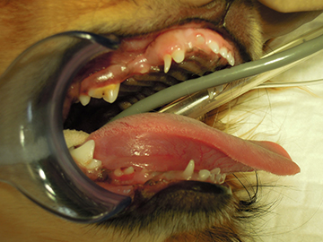 埋伏歯の症例
