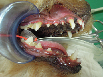 麻酔歯科処置（予防歯科）の症例